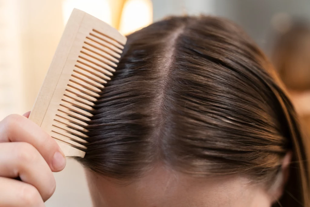 Pelo graso
